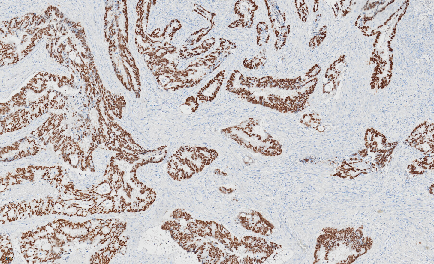 Tissue-Tek Genie anti-SATB2