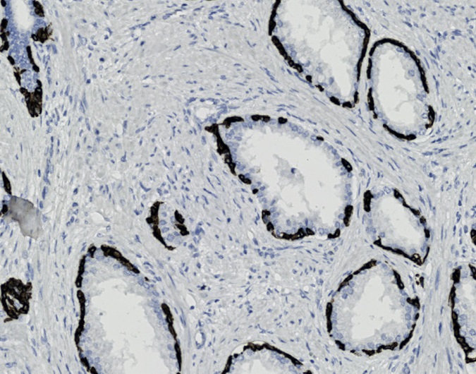 Tissue-Tek Genie<sup>®</sup><br /> anti-Cytokeratin 14 Tissue-Tek Genie<sup>®</sup><br /> anti-Cytokeratin 14
