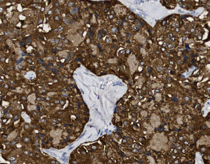 Tissue-Tek Genie<sup>®</sup><br /> anti-Chromogranin A Tissue-Tek Genie<sup>®</sup><br /> anti-Chromogranin A