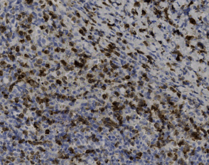 Tissue-Tek Genie<sup>®</sup><br /> anti-Perforin Tissue-Tek Genie<sup>®</sup><br /> anti-Perforin