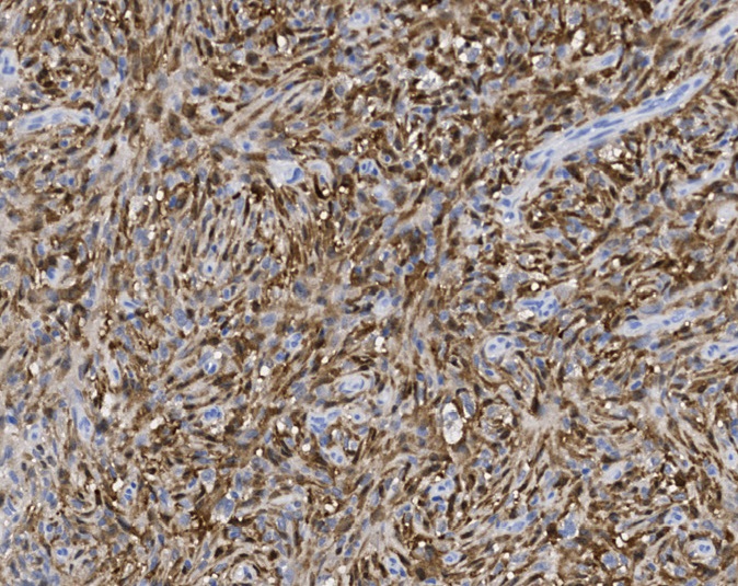 Tissue-Tek Genie<sup>®</sup><br /> anti-Factor XIIIa Tissue-Tek Genie<sup>®</sup><br /> anti-Factor XIIIa