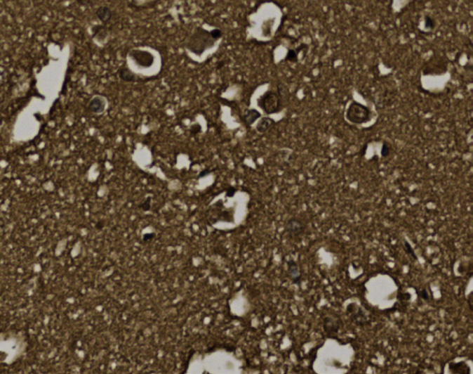 Tissue-Tek Genie<sup>®</sup><br /> anti-CD57 Tissue-Tek Genie<sup>®</sup><br /> anti-CD57