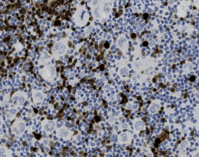 Tissue-Tek Genie<sup>®</sup><br /> anti-BOB.1 Tissue-Tek Genie<sup>®</sup><br /> anti-BOB.1
