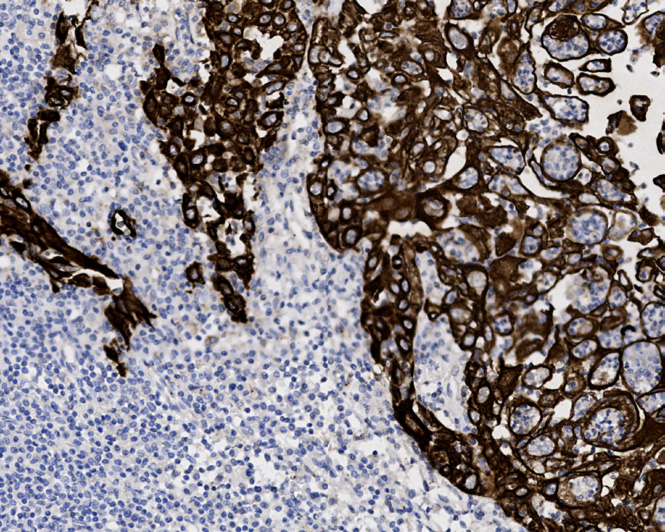 Tissue-Tek Genie<sup>®</sup><br /> anti-Cytokeratin HMW (CK5) Tissue-Tek Genie<sup>®</sup><br /> anti-Cytokeratin HMW (CK5)