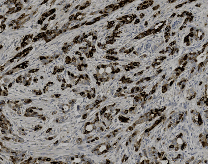 Tissue-Tek Genie<sup>®</sup><br /> anti-Mammaglobin Tissue-Tek Genie<sup>®</sup><br /> anti-Mammaglobin