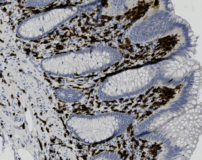 Tissue-Tek Genie<sup>®</sup><br /> anti-CD163 Tissue-Tek Genie<sup>®</sup><br /> anti-CD163