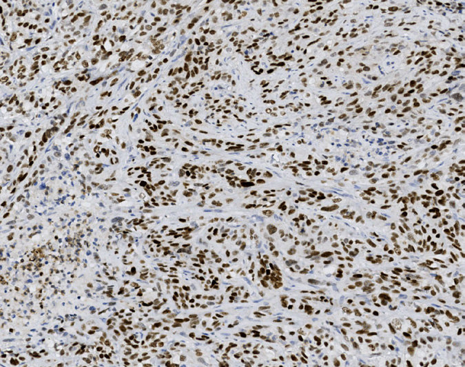 Tissue-Tek Genie<sup>®</sup><br /> anti-GATA3 Tissue-Tek Genie<sup>®</sup><br /> anti-GATA3