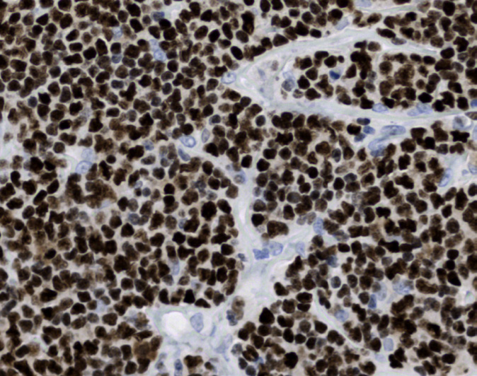Tissue-Tek Genie<sup>®</sup><br /> anti-OCT.2 Tissue-Tek Genie<sup>®</sup><br /> anti-OCT.2