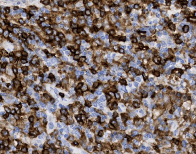 Tissue-Tek Genie<sup>®</sup><br /> anti-CD4 Tissue-Tek Genie<sup>®</sup><br /> anti-CD4