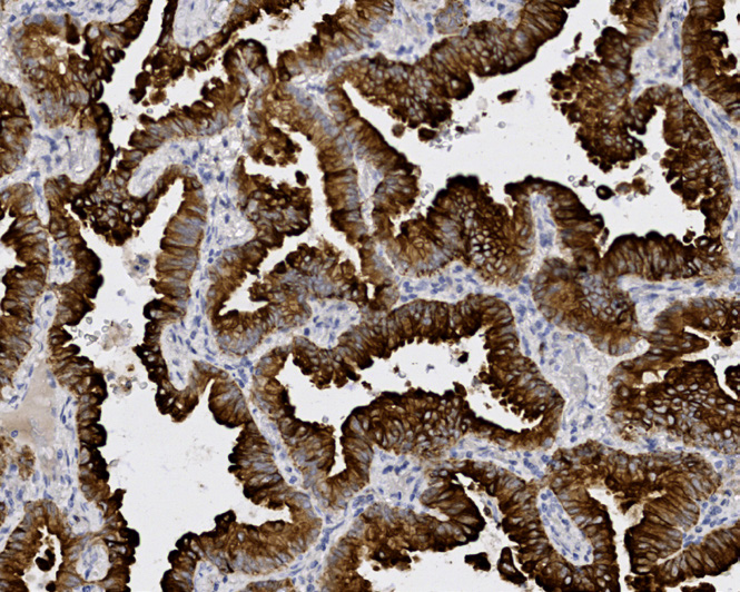 Tissue-Tek Genie anti-Cytokeratin 7