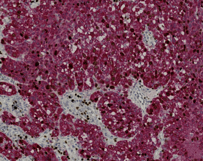 Tissue-Tek Genie<sup>®</sup> DUO<br /> anti-Melan-A / Ki67 Antibody Cocktail Tissue-Tek Genie<sup>®</sup> DUO<br /> anti-Melan-A / Ki67 Antibody Cocktail