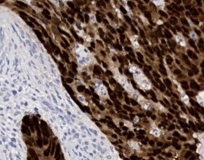 Tissue-Tek Genie<sup>®</sup><br /> anti-CDX2 Tissue-Tek Genie<sup>®</sup><br /> anti-CDX2