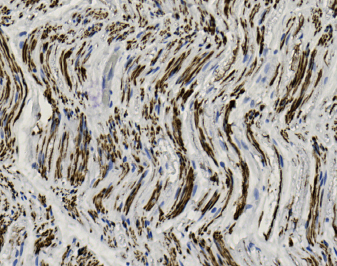 Tissue-Tek Genie<sup>®</sup><br /> anti-Neurofilament Tissue-Tek Genie<sup>®</sup><br /> anti-Neurofilament