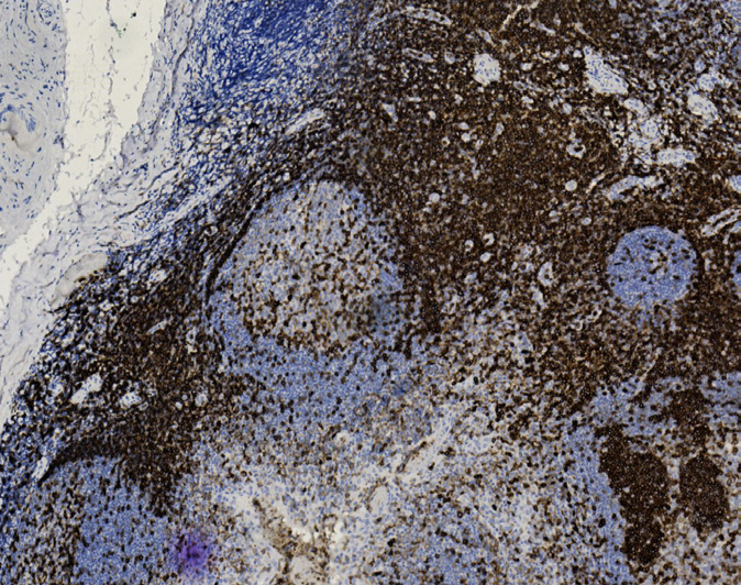 Tissue-Tek Genie<sup>®</sup><br /> anti-CD43 Tissue-Tek Genie<sup>®</sup><br /> anti-CD43
