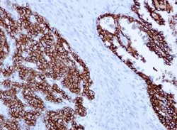 Epithelial Cell Adhesion Molecule (EpCam)