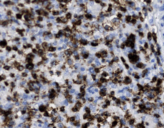 Tissue-Tek Genie<sup>®</sup><br /> anti-CD2 Tissue-Tek Genie<sup>®</sup><br /> anti-CD2