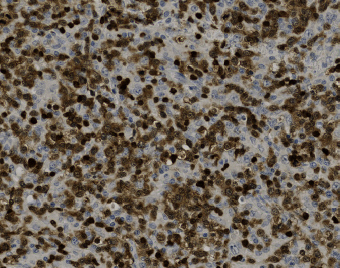 Tissue-Tek Genie<sup>®</sup><br /> anti-ZAP70 Tissue-Tek Genie<sup>®</sup><br /> anti-ZAP70