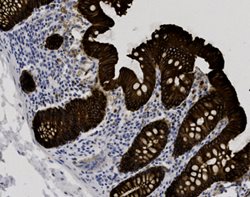 Tissue-Tek Genie<sup>®</sup><br />
anti-Cytokeratin LMW (CK8/18) Antibody Cocktail [EP17/DC10]