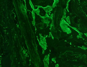 Tissue-Tek Genie<sup>®</sup> FITC<br /> anti-Fibrinogen Tissue-Tek Genie<sup>®</sup> FITC<br /> anti-Fibrinogen
