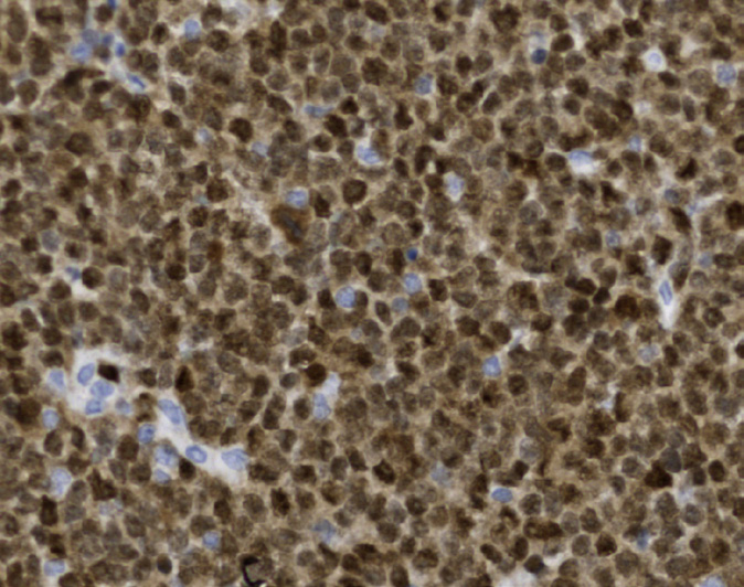 Tissue-Tek Genie<sup>®</sup><br /> anti-MUM-1 Tissue-Tek Genie<sup>®</sup><br /> anti-MUM-1