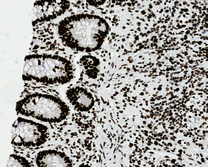 Tissue-Tek Genie<sup>®</sup><br /> anti-MSH2 Tissue-Tek Genie<sup>®</sup><br /> anti-MSH2