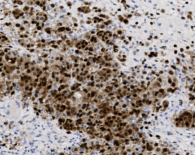 Tissue-Tek Genie<sup>®</sup><br /> anti-SOX10 Tissue-Tek Genie<sup>®</sup><br /> anti-SOX10