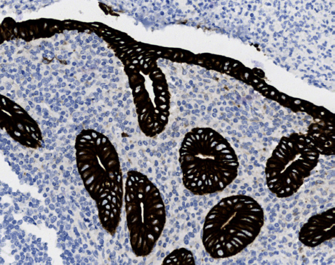 Tissue-Tek Genie<sup>® </sup><br /> anti-Cytokeratin 18 Tissue-Tek Genie<sup>® </sup><br /> anti-Cytokeratin 18