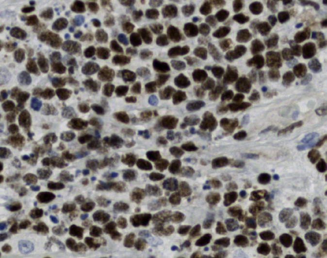 Tissue-Tek Genie<sup>®</sup><br /> anti-c-Myc Tissue-Tek Genie<sup>®</sup><br /> anti-c-Myc