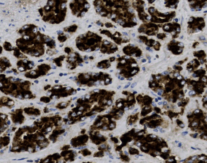 Tissue-Tek Genie<sup>®</sup><br /> anti-Prostate Specific Antigen Tissue-Tek Genie<sup>®</sup><br /> anti-Prostate Specific Antigen