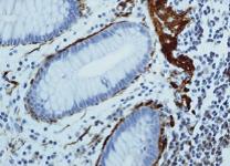 Immunohistochemistry Reagents