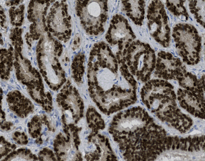Tissue-Tek Genie<sup>®</sup><br /> anti-NKX3.1 Tissue-Tek Genie<sup>®</sup><br /> anti-NKX3.1