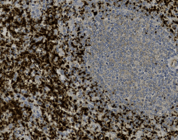 Tissue-Tek Genie<sup>®</sup><br /> anti-CD61 Tissue-Tek Genie<sup>®</sup><br /> anti-CD61