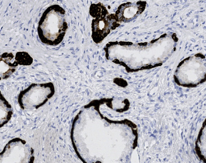 Tissue-Tek Genie<sup>&reg;</sup><br /> anti-Cytokeratin HMW