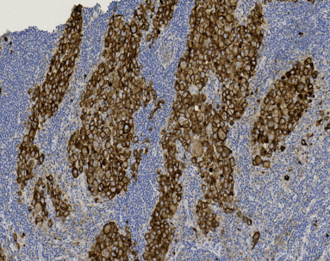 Tissue-Tek Genie<sup>®</sup><br /> anti-CD63 Tissue-Tek Genie<sup>®</sup><br /> anti-CD63