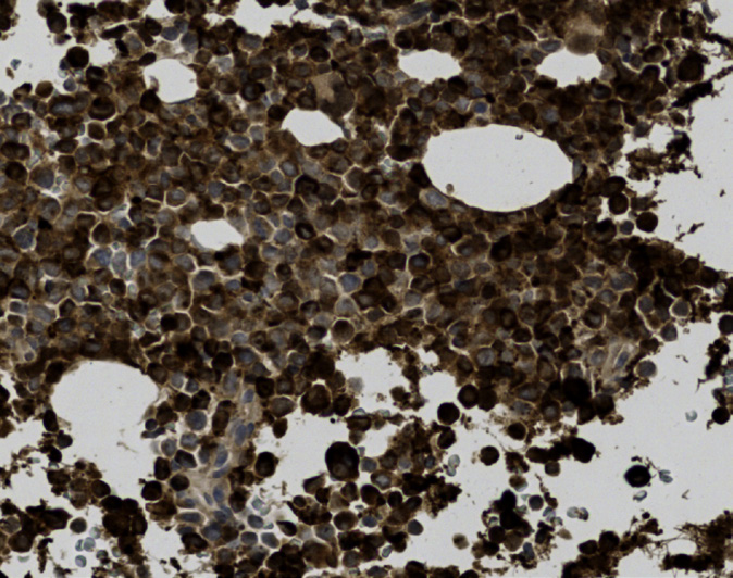 Tissue-Tek Genie<sup>®</sup><br /> anti-Lysozyme Tissue-Tek Genie<sup>®</sup><br /> anti-Lysozyme