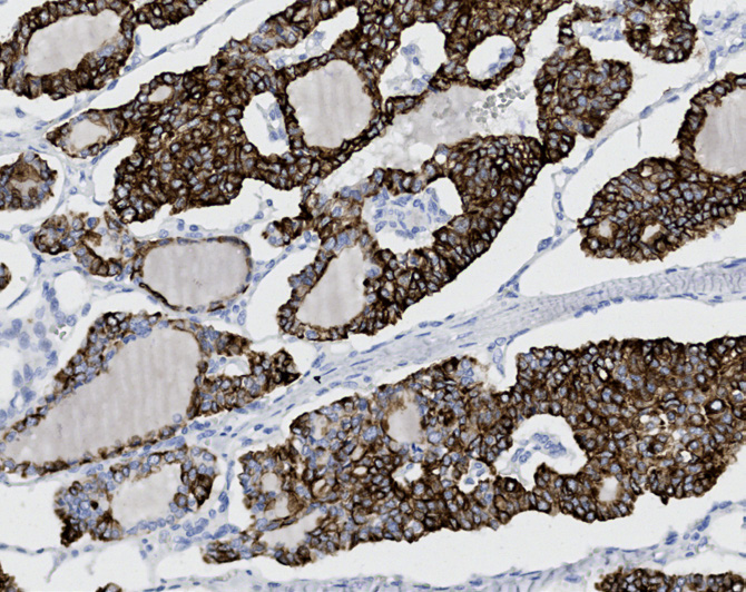 Tissue-Tek Genie<sup>®</sup><br /> anti-Cytokeratin 19 Tissue-Tek Genie<sup>®</sup><br /> anti-Cytokeratin 19
