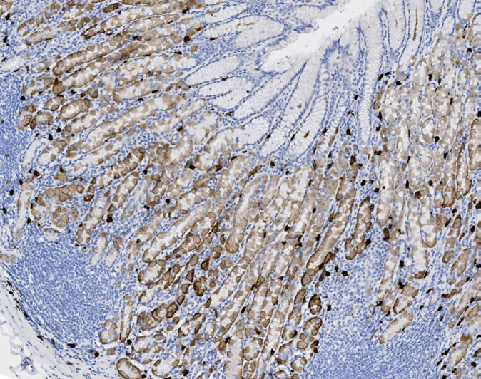 Tissue-Tek Genie<sup>®</sup><br /> anti-CD117 (c-kit) Tissue-Tek Genie<sup>®</sup><br /> anti-CD117 (c-kit)