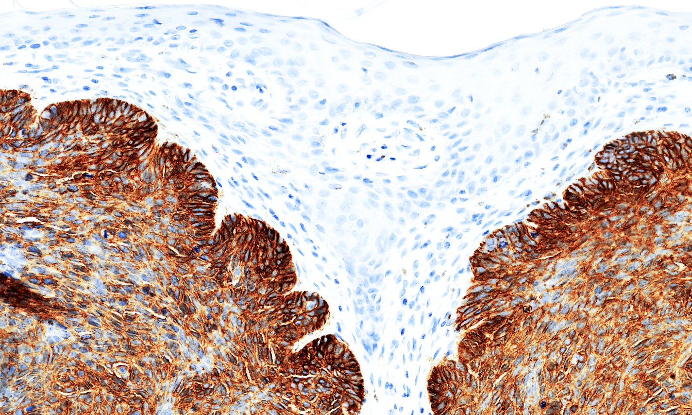 Tissue-Tek Genie anti-Epithelial Cell Adhesion Molecule