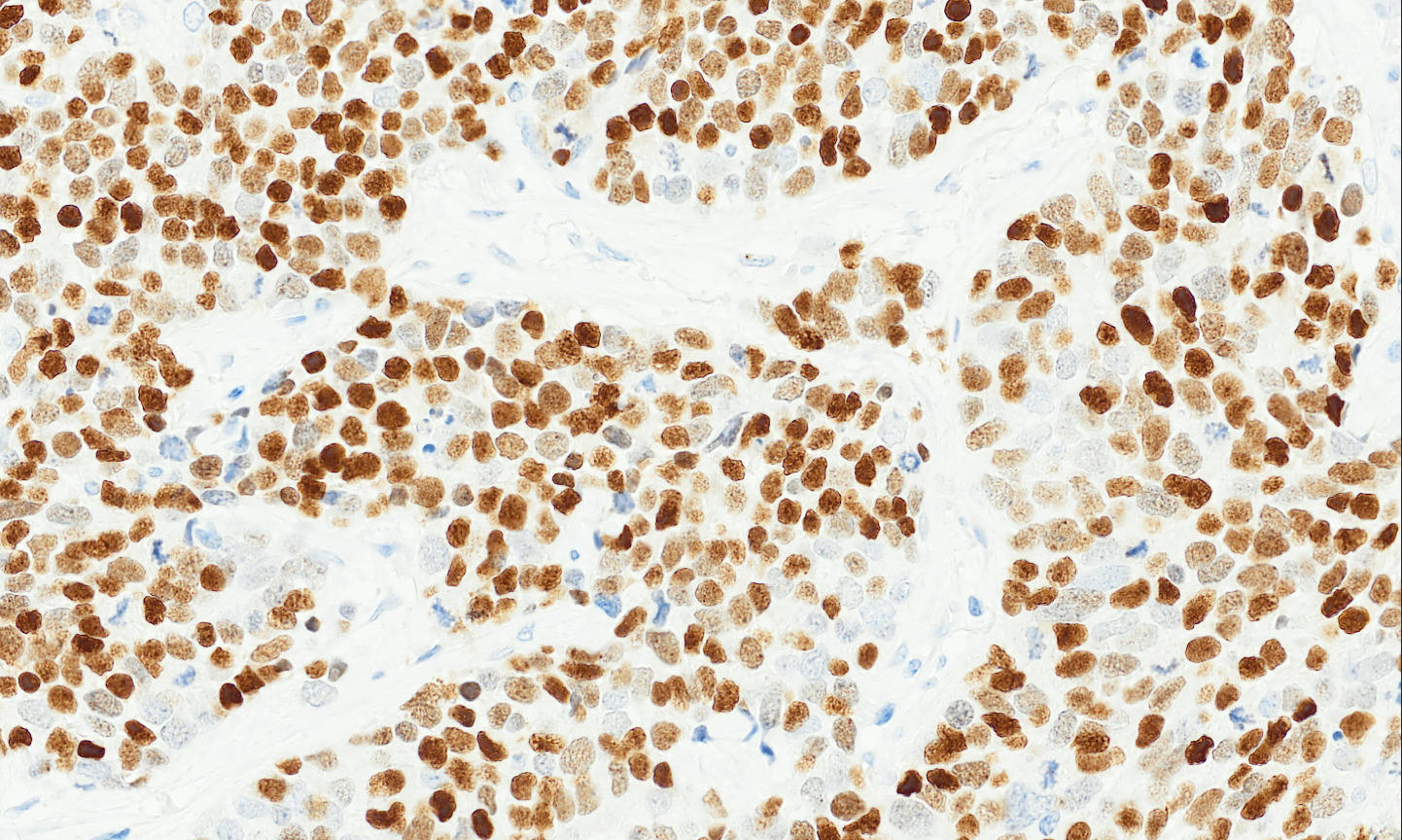 Tissue-Tek Genie anti-INSM1