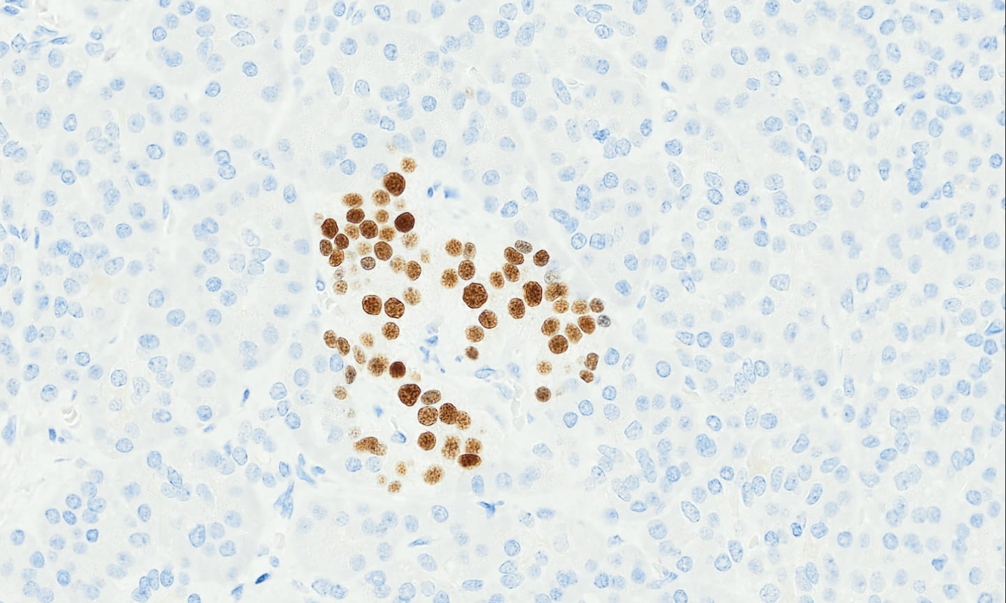 INSM1-2-(2).jpg
