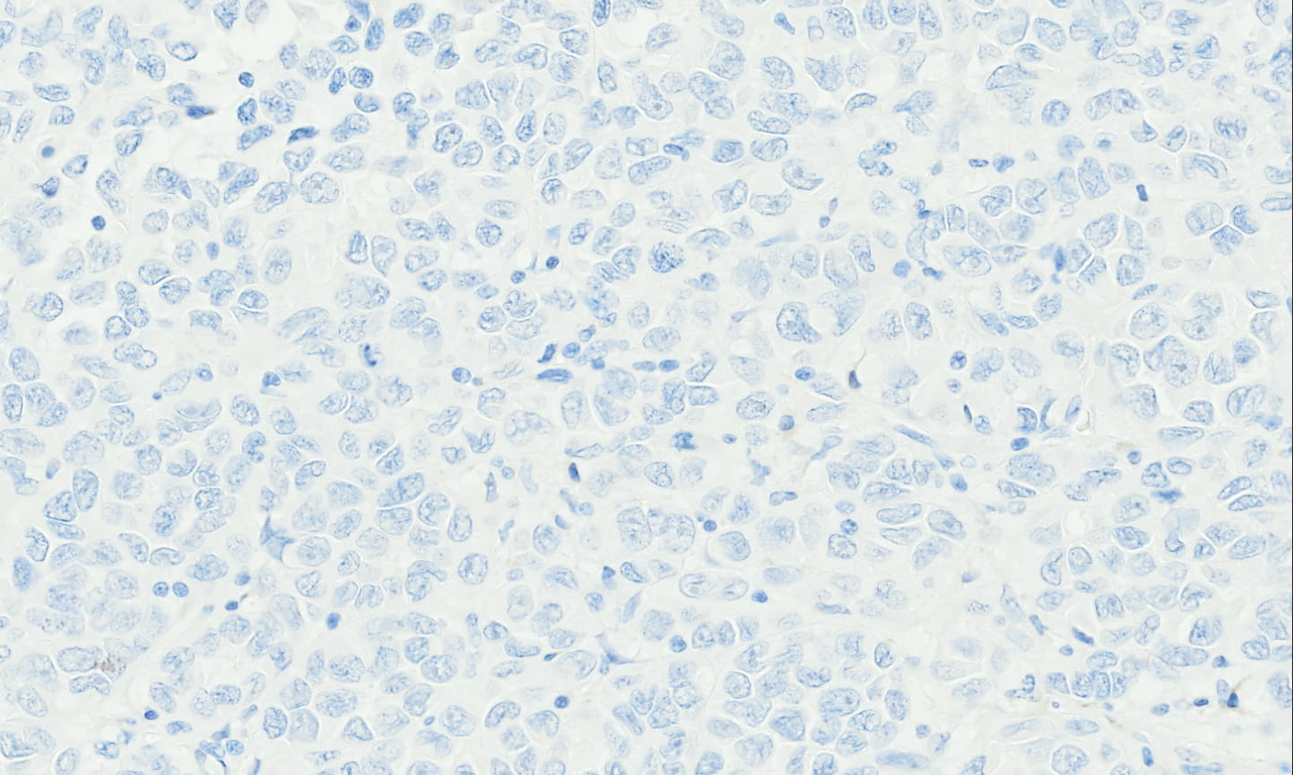 INSM1-3-(2).jpg