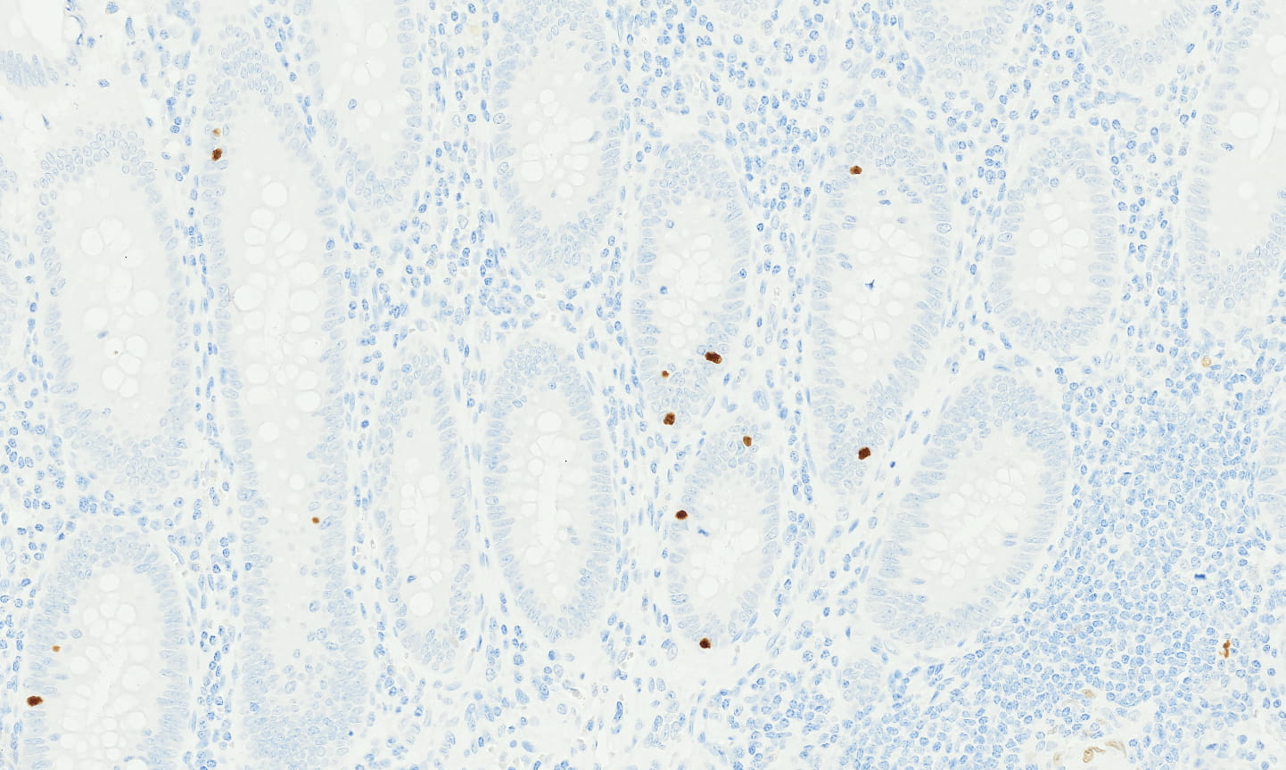 INSM1-4-(2).jpg