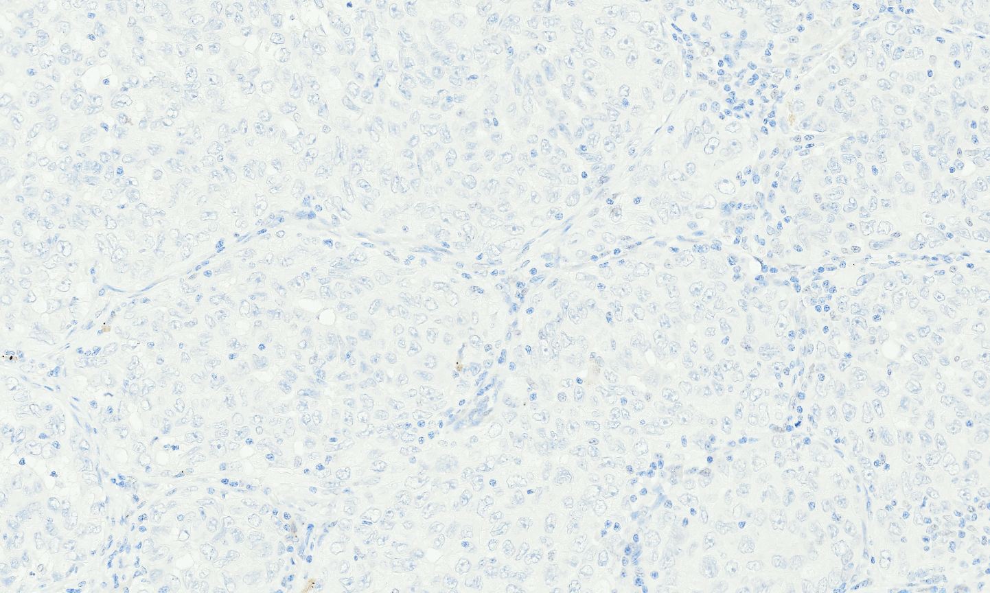 TRPS1-4-(1).jpg