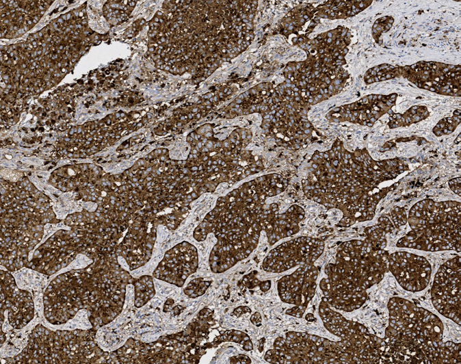 Tissue-Tek Genie<sup>®</sup><br /> anti-Napsin A Tissue-Tek Genie<sup>®</sup><br /> anti-Napsin A