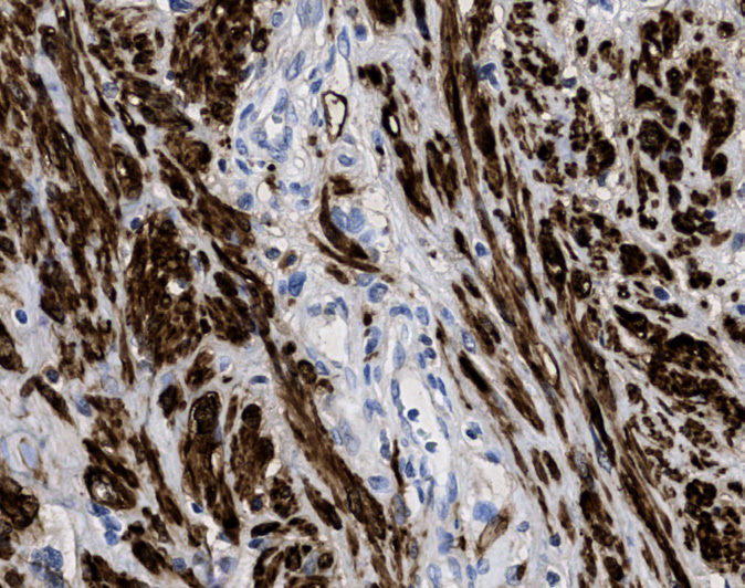 Tissue-Tek Genie<sup>®</sup><br /> anti-Calponin Tissue-Tek Genie<sup>®</sup><br /> anti-Calponin