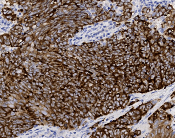 Tissue-Tek Genie<sup>®</sup><br /> anti-Synaptophysin Tissue-Tek Genie<sup>®</sup><br /> anti-Synaptophysin