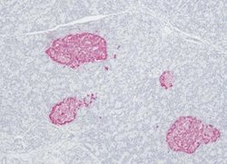 Chromogranin A