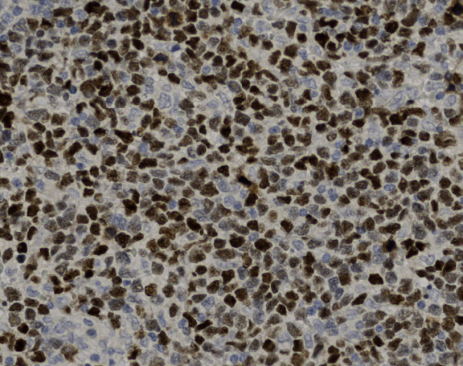 Tissue-Tek Genie<sup>®</sup><br /> anti-SOX11 Tissue-Tek Genie<sup>®</sup><br /> anti-SOX11