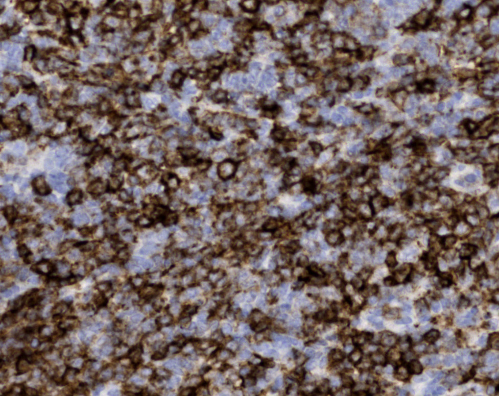 Tissue-Tek Genie<sup>®</sup><br /> anti-CD23 Tissue-Tek Genie<sup>®</sup><br /> anti-CD23