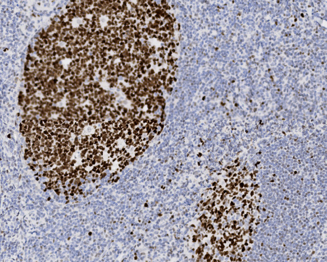 Tissue-Tek Genie<sup>®</sup><br /> anti-BCL6 Tissue-Tek Genie<sup>®</sup><br /> anti-BCL6